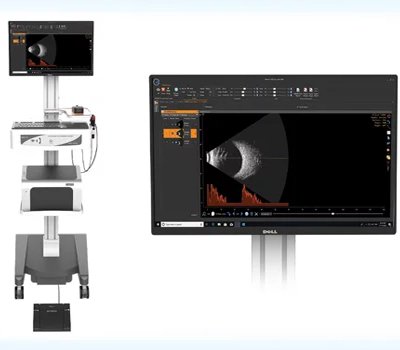 APPASAMY ULTRASOUND A&B SCAN