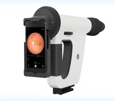 HAND HALER FUNDUS CAMERA