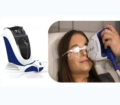 E-EYE FOR DRY EYES TREATMENT